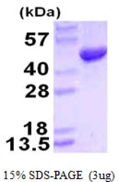 Human HMBS protein, His tag. GTX67463-pro