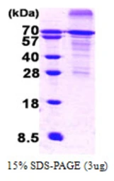 Human HSF1 protein, His tag. GTX67481-pro