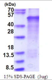 Human LMX1B protein, His tag. GTX67524-pro