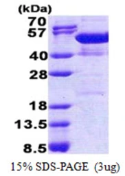 Human NAP1L4 protein, His tag. GTX67575-pro