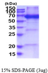 Human NARS protein, His tag. GTX67576-pro