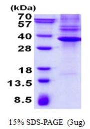 Human Nkx3.1 protein, His tag. GTX67593-pro