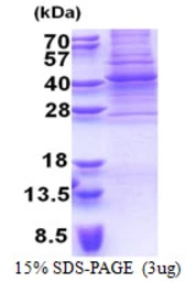 Human PAX9 protein, His tag. GTX67614-pro