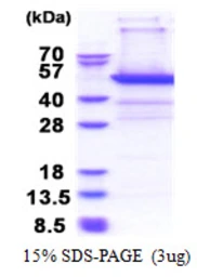 Human PSMD11 protein, His tag. GTX67701-pro