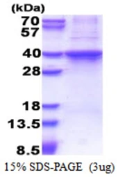 Human Rad51D protein, His tag. GTX67736-pro