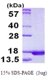 Human RPLP2 protein, His tag. GTX67769-pro