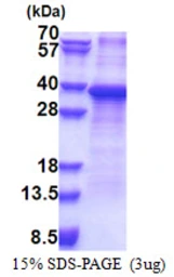 Human RPS2 protein, His tag. GTX67770-pro