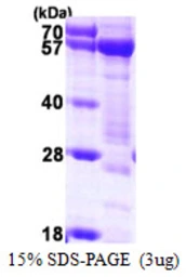 Human Syntrophin alpha 1 protein, His tag. GTX67845-pro