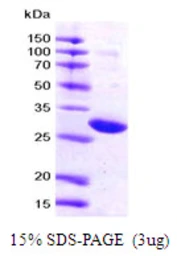 Human 14-3-3 zeta protein, His tag. GTX67947-pro