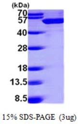 Human UAP56 protein, His tag. GTX67954-pro