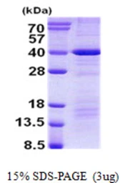 Human DEDD protein, His tag. GTX68033-pro