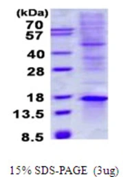 Human TIAF1 protein, His tag. GTX68035-pro