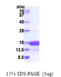 Human HMGN3 protein, His tag. GTX68045-pro