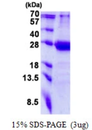 Human TRFP protein, His tag. GTX68067-pro