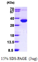 Human CCS protein, His tag. GTX68099-pro