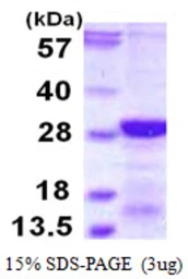 Human RCAN2 protein, His tag. GTX68129-pro
