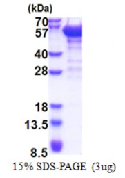 Human DCTN2 protein, His tag. GTX68172-pro