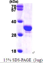 Human SCGN protein, His tag. GTX68178-pro