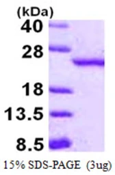 Human RBBP9 protein, His tag. GTX68190-pro