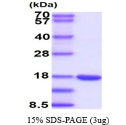 Mouse Galectin 7 protein, His tag. GTX68271-pro