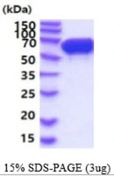 Mouse STIP1 protein, His tag. GTX68294-pro
