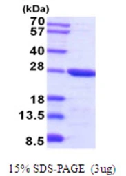 Mouse TCTP protein, His tag. GTX68297-pro