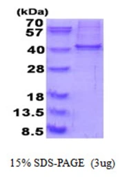 Human RALY protein, His tag. GTX68300-pro