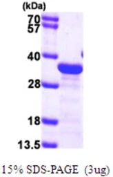Human EB1 protein, His tag. GTX68302-pro