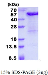 Human KIN protein, His tag. GTX68308-pro