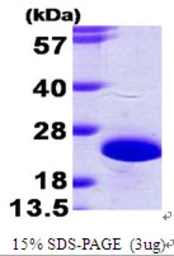 Human NCS1 protein, His tag. GTX68322-pro