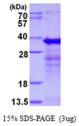 Human DEDAF protein, His tag. GTX68325-pro