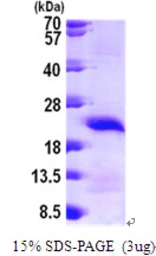Human CRHSP-24 protein, His tag. GTX68340-pro