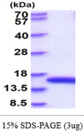 Rat L-FABP protein, His tag. GTX68352-pro