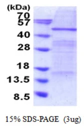 Human ELP4 protein, His tag. GTX68386-pro