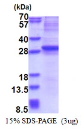 Human NGN3 protein, His tag. GTX68457-pro