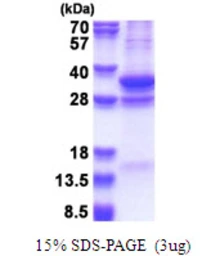 Human COPS7A protein, His tag. GTX68459-pro