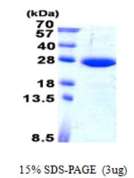 Human SAR1B protein, His tag. GTX68479-pro