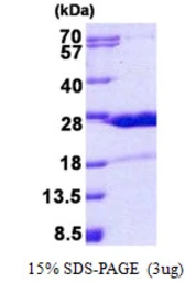 Human HN1 protein, His tag. GTX68482-pro