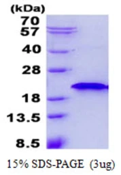 Human RNF181 protein, His tag. GTX68494-pro