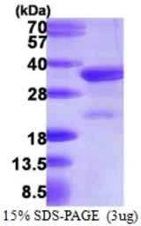 Human VPS24 protein, His tag. GTX68528-pro