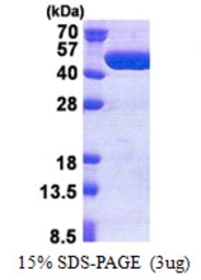 Human TBC1D13 protein, His tag. GTX68557-pro