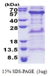Human TIPIN protein, His tag. GTX68569-pro