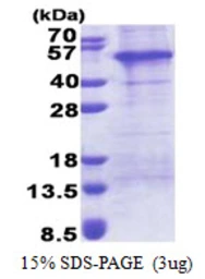 Human AP1AR protein, His tag. GTX68594-pro