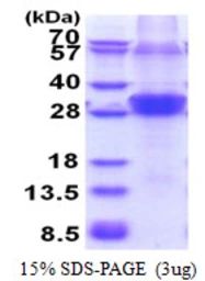 Human ZNF313 protein, His tag. GTX68622-pro