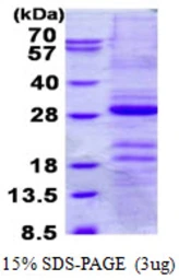 Human Gastrokine 1 protein, His tag. GTX68626-pro