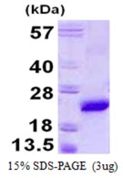 Mouse VPS29 protein, His tag. GTX68628-pro