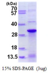 Human DNAJC12 protein, His tag. GTX68629-pro