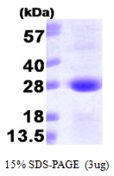 Human SAR1A protein, His tag. GTX68633-pro