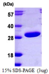 Human PRTFDC1 protein, His tag. GTX68642-pro