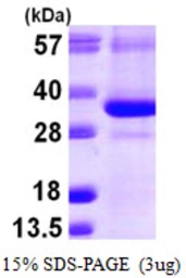 Human CTDSP1 protein, His tag. GTX68669-pro